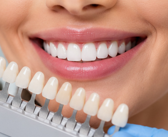 Smile Designing
